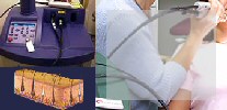 épilation laser